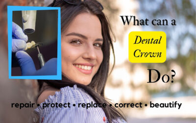 Dental Crowns What They Are and Why do We Need Them?
