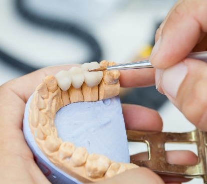 a person is working on a model of a tooth for dental bridges sherman tx