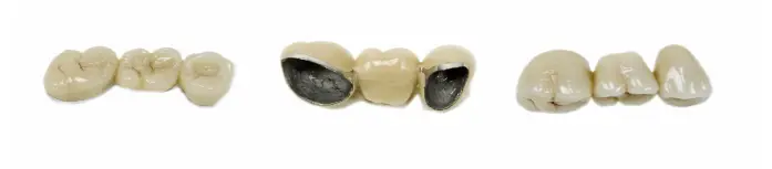 three different types of dental crown sherman tx on a white background