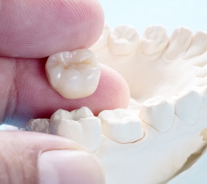 a person holding a dental crown sherman in front of a model of a tooth