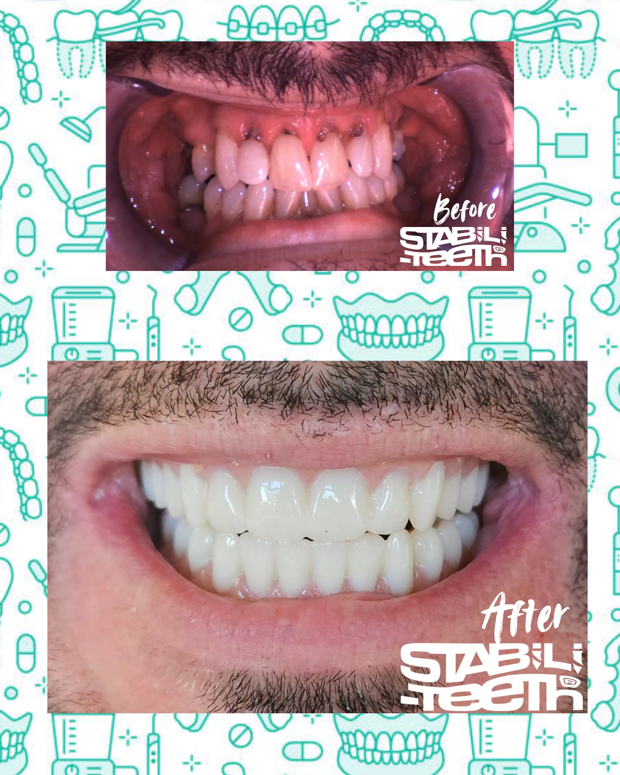 fullmouth BEFORE/AFTER Gallery