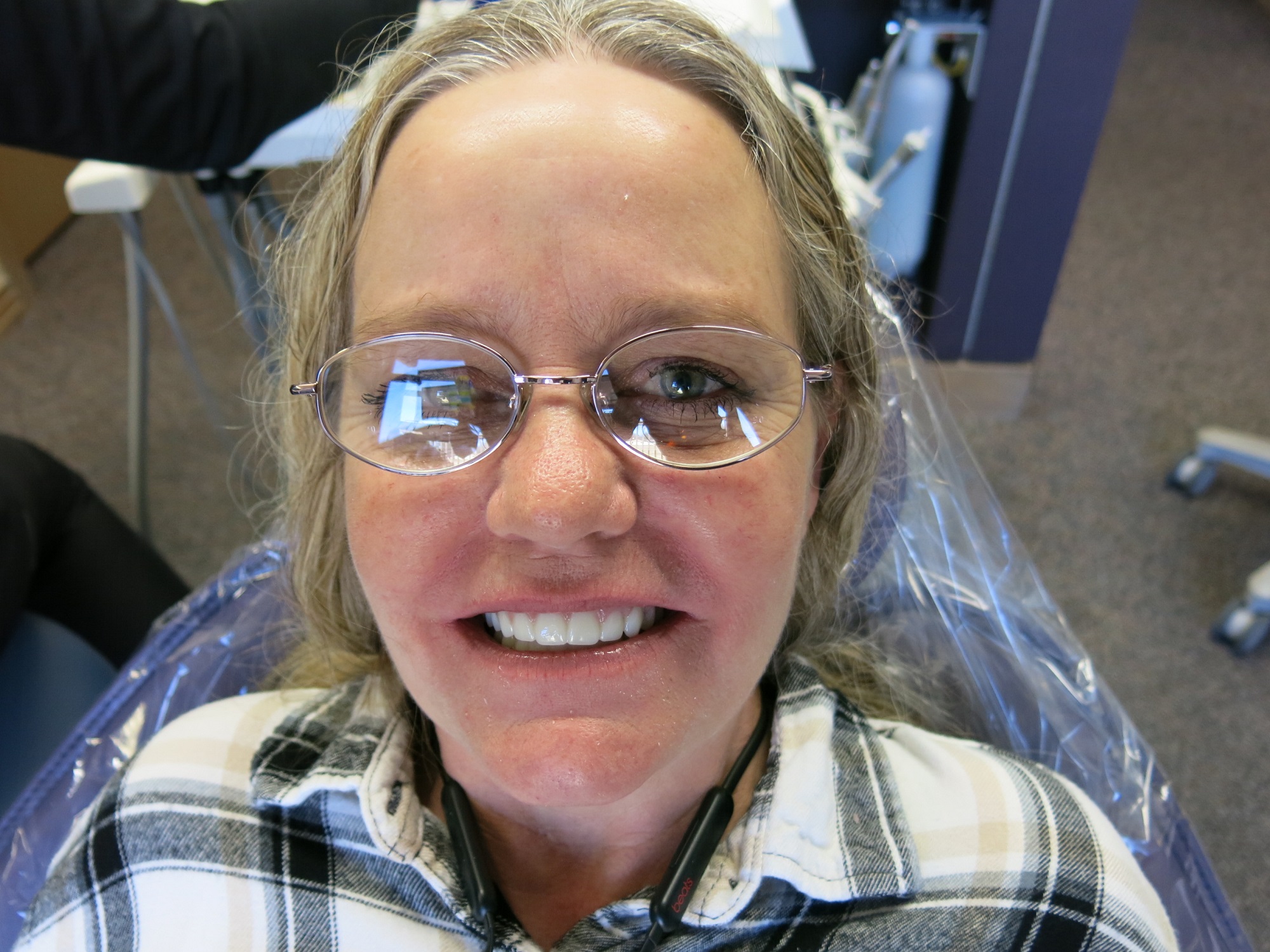 fullmouth2 BEFORE/AFTER Gallery